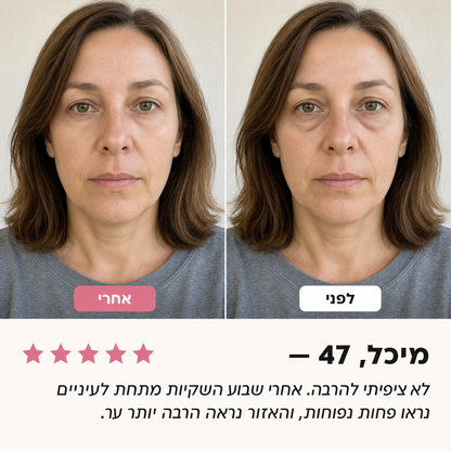 לפני ואחרי